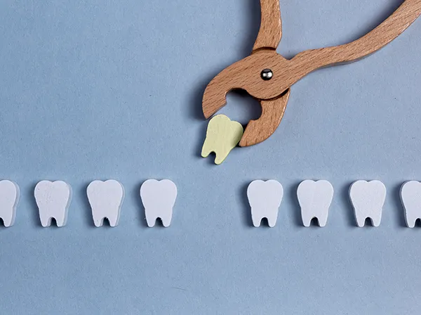 Row of wooden tooth shapes, one of which is being pulled out of the row by dental pliers.