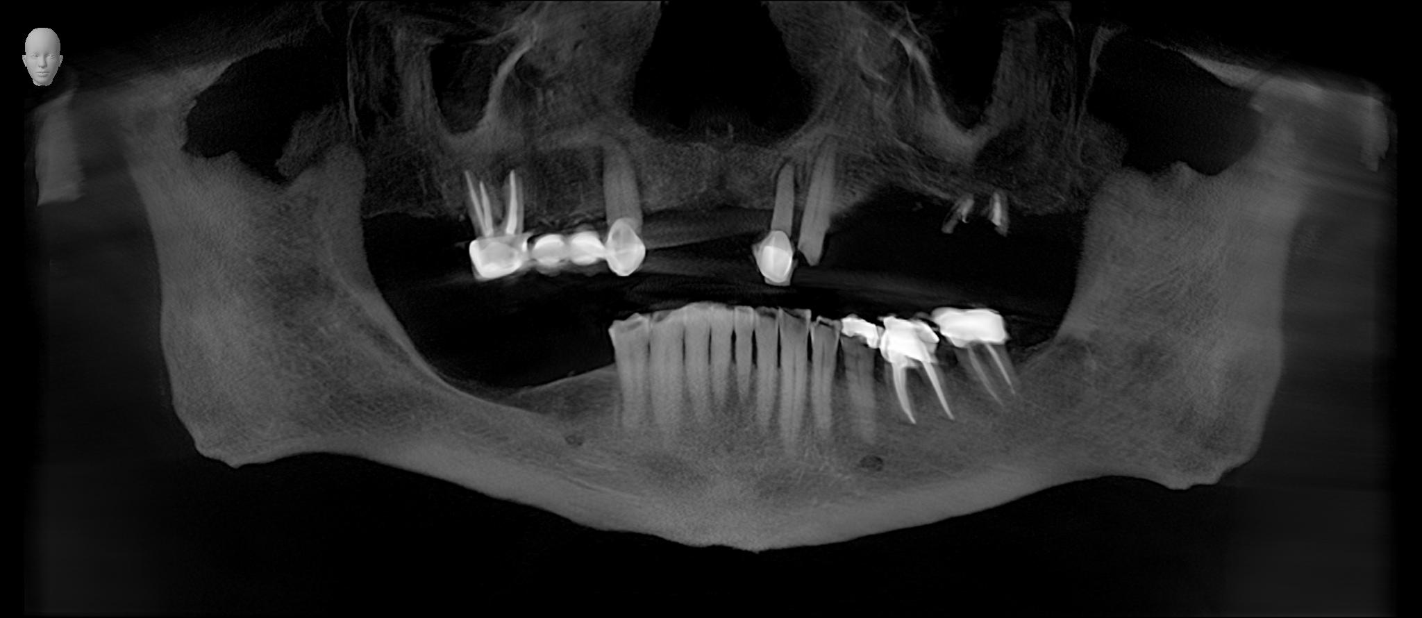 thompson caroline 3D examination(1) VO3 154449 Panorama