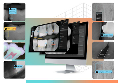 Visual of a dental x-ray scan using Pearl AI technology.