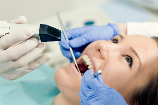 Smiling woman's teeth being scanned with intraoral camera at Djawdan Center for Implant and Restorative Dentistry.